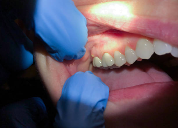 Best Emergency Dental Care for Trauma or Injury in Weber City, VA